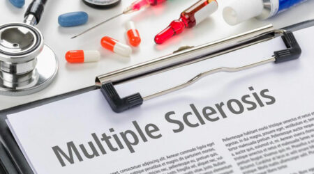 5 common symptoms of multiple sclerosis