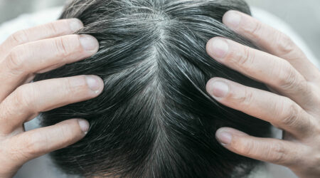 6 home remedies for graying hair