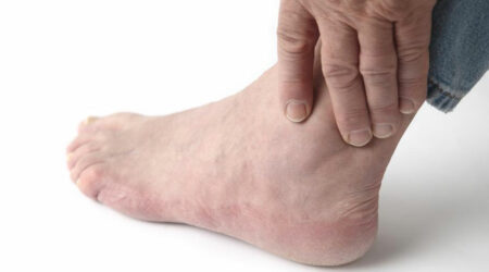 3 Daily habits to avoid foot pain