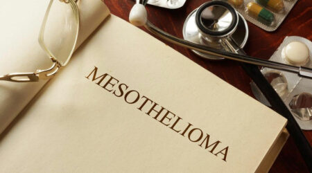 Everything you should know about Mesothelioma