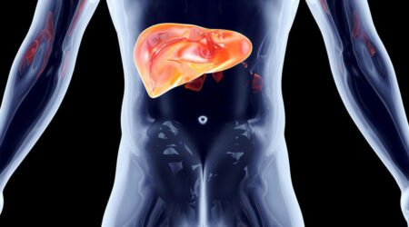 What does stage 4 Hepatitis C mean for your liver